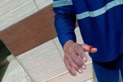 Gari após acidente com material cortante.