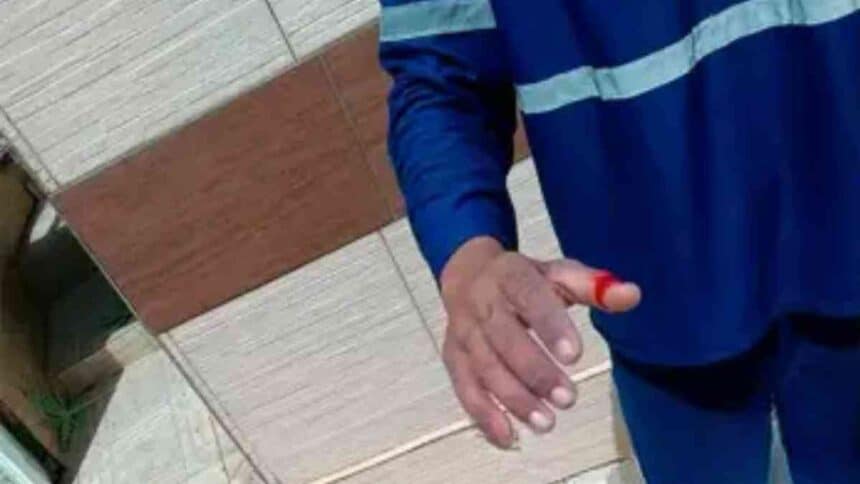 Gari após acidente com material cortante.