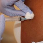 Profissional de saúde aplicando vacina contra chikungunya em morador de Lagarto.