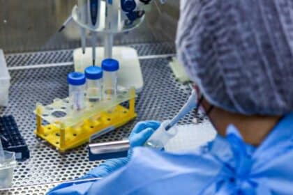 Laboratório do Lacen realiza análise para confirmar Gripe K em Sergipe.